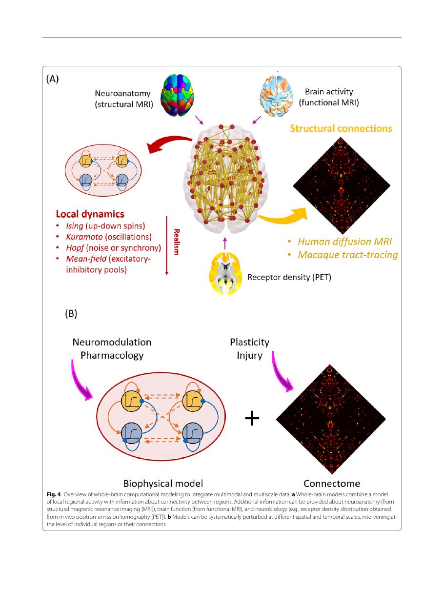 Mechanisms Underlying Disorders of Consciousness